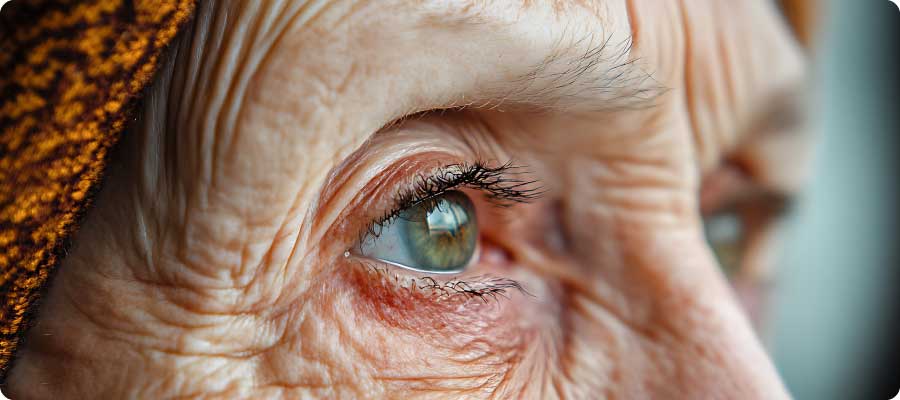 oeil personne agée